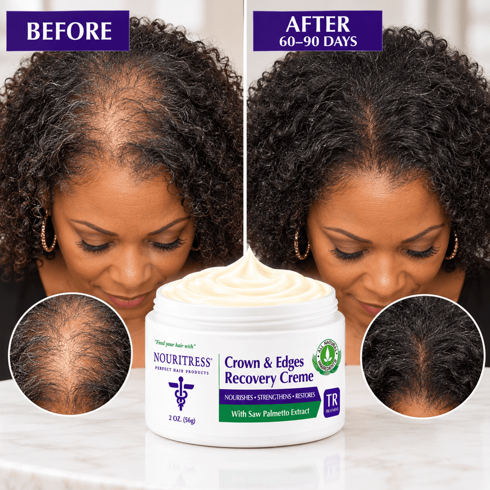 NouriTress Crown & Edges Recovery Crème - NouriTress Hair Products