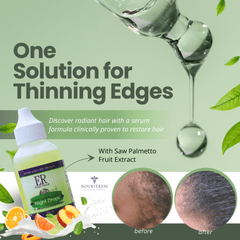 Edge Repair Follicle Treatment System for Natural Hair - NouriTress Hair Products