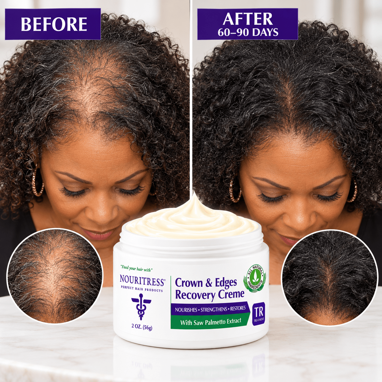 NouriTress Crown & Edges Recovery Crème - NouriTress Hair Products